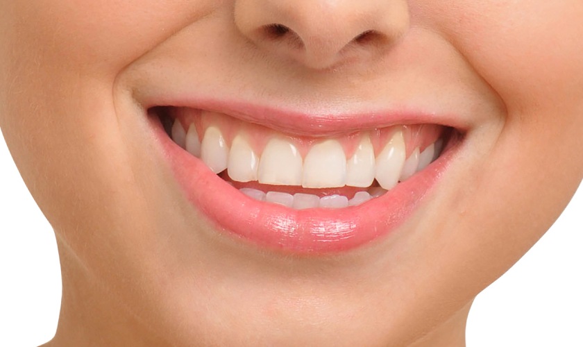 teeth_whitening