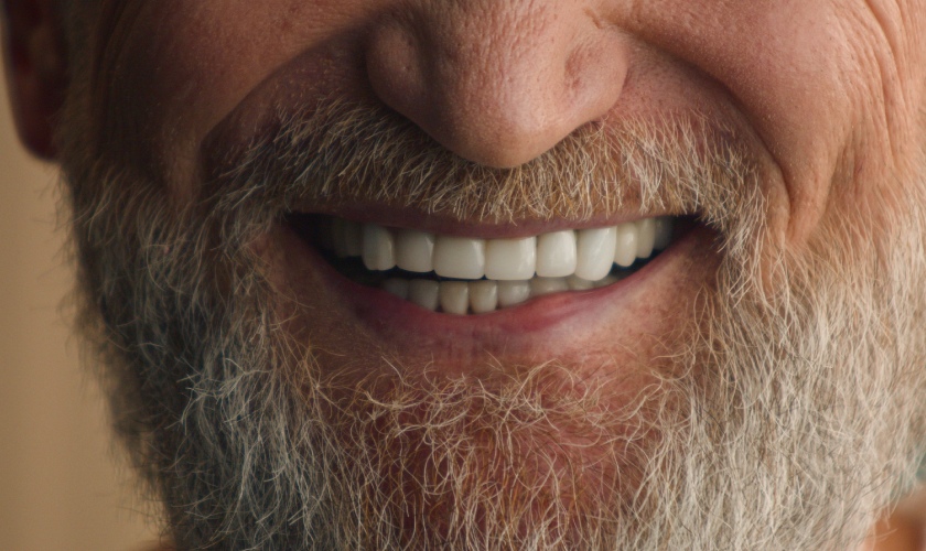 smile_makeover